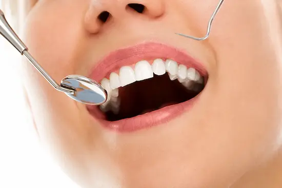 clareamento dental Sorocaba